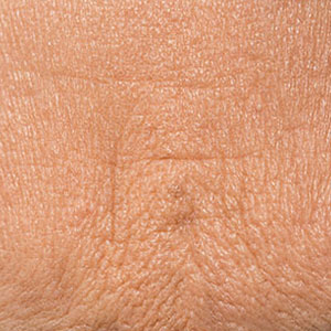 Skinlastiq Medical Laser Cosmetic Spa treats fine lines