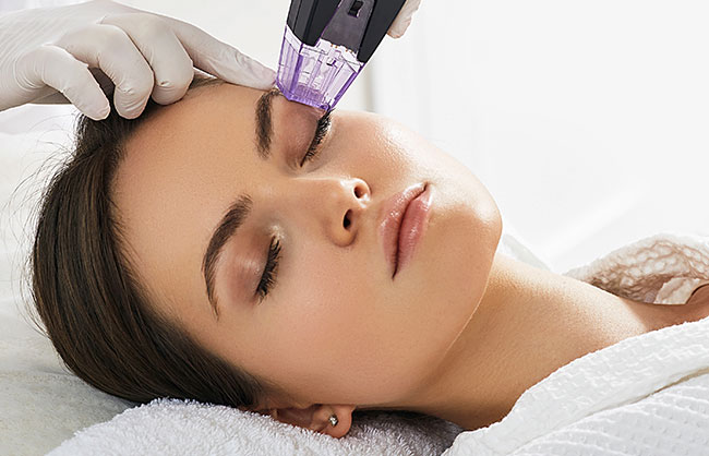 Patient receiving microneedling at Skinlastiq Medical Laser Cosmetic Spa in Burlingame