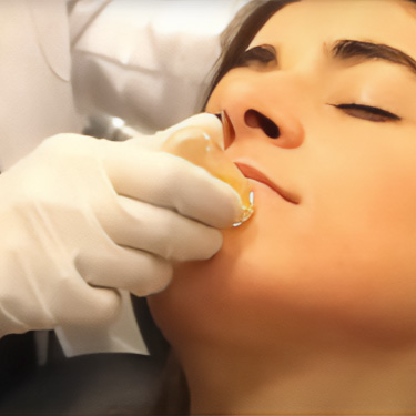 Patient receiving aquagold at Skinlastiq Medical Laser Cosmetic Spa in Burlingame