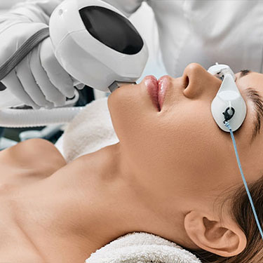 Patient receiving lumecca for broken capillaries at Skinlastiq Medical Laser Cosmetic Spa in Burlingame