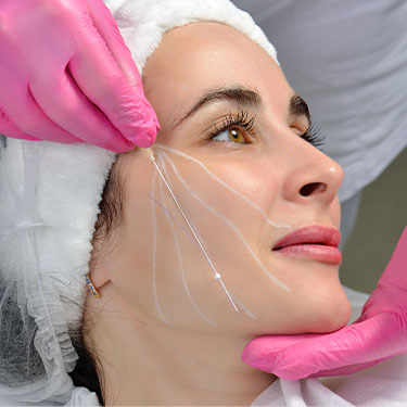 Patient receiving pdo threads for wrinkles at Skinlastiq Medical Laser Cosmetic Spa in Burlingame